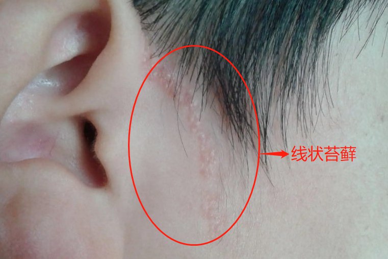 线状苔藓图片