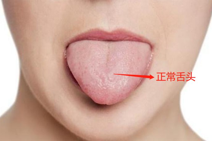 正常人的舌头图片