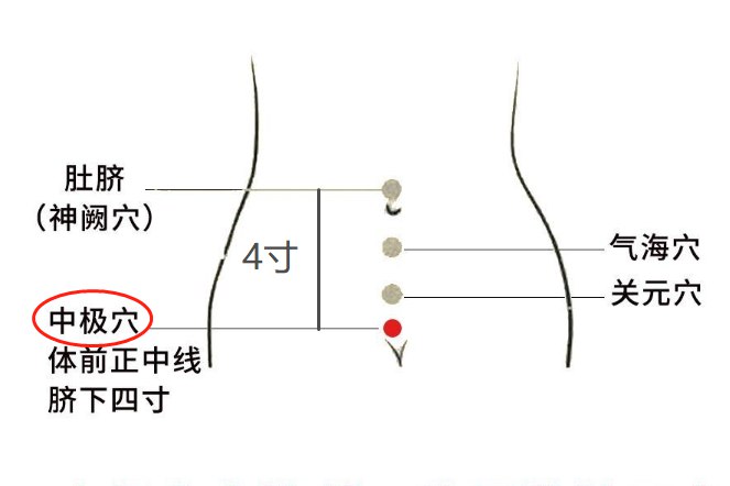 中极穴准确位置图片
