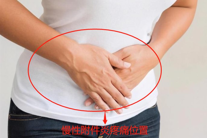 女性慢性附件炎疼痛位置图