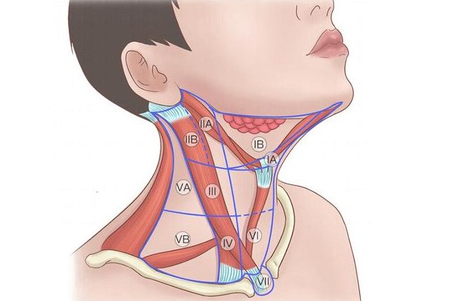淋巴结节位置图片