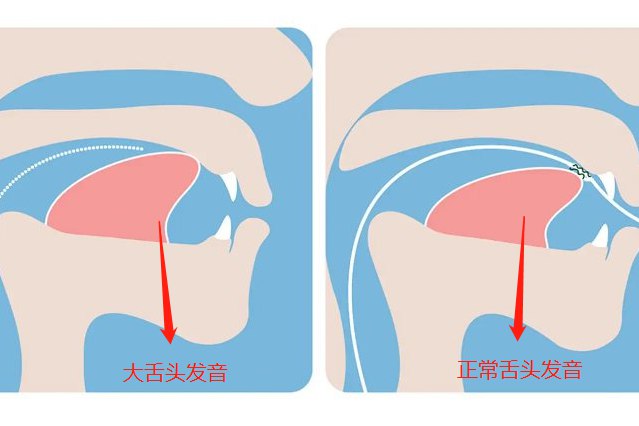 大舌头正常图片