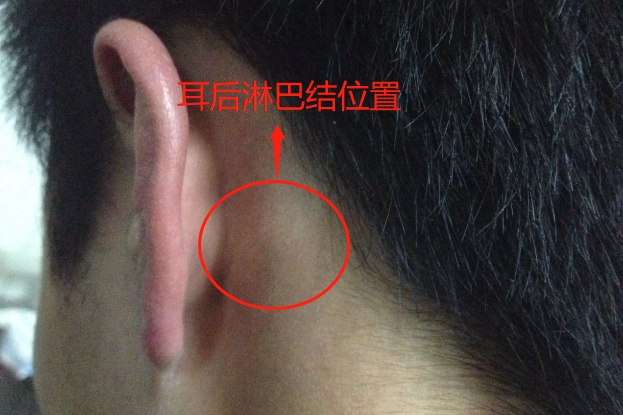 耳朵前面的淋巴位置图图片