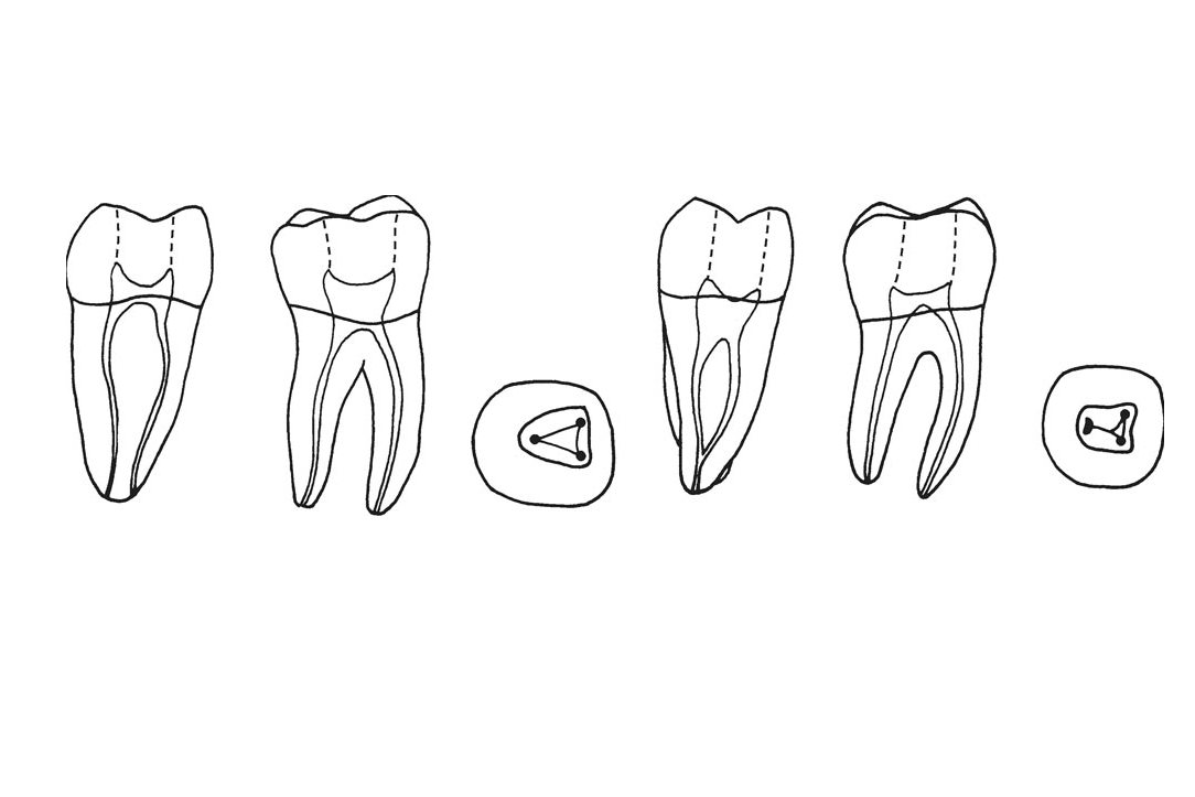 牙本质小管图片简化图图片