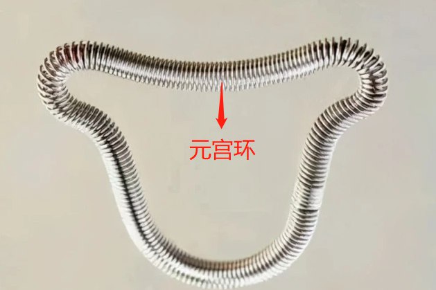 1,元宫环元宫环是一种经典的含药金属节育器,其中含有铜离子