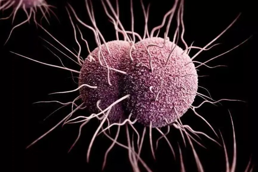 男性淋球菌图片