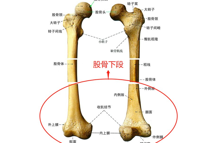 股骨小转子位置图片