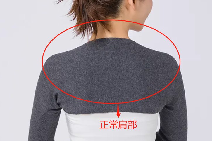 正常肩膀图片