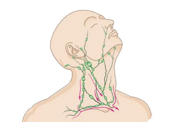 脖子淋巴结图片位置图片