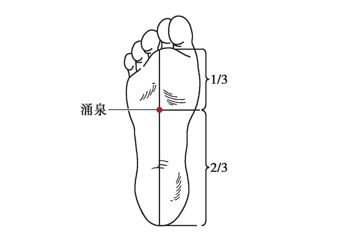 2,獨陰穴獨陰穴位於足第2趾的蹠側遠端趾間關節的中點,局部解剖布有趾